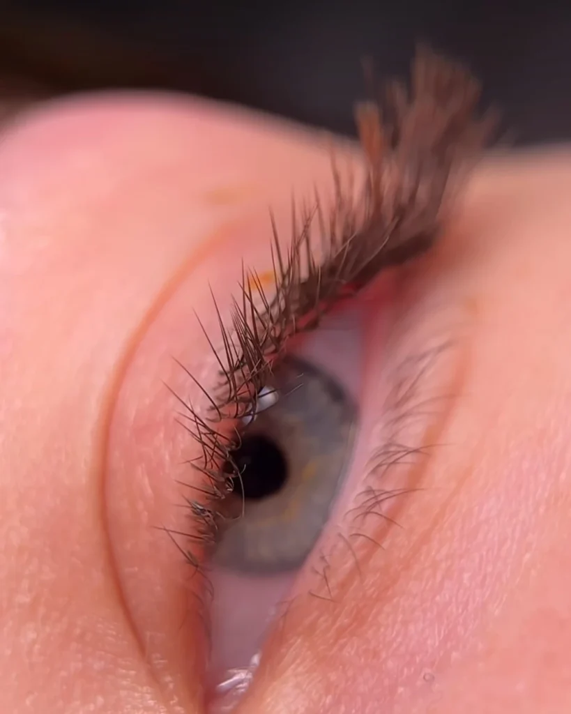 lashinc umelecke predlzovanie mihalnic